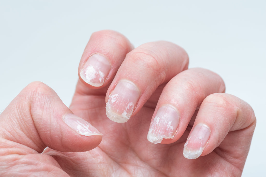 Do Gel Nail Strips Damage Your Nails? The Truth Explained