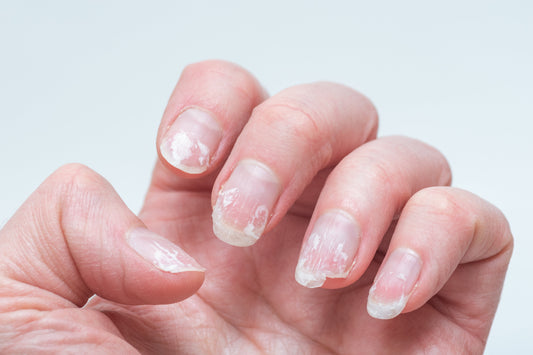 Do Gel Nail Strips Damage Your Nails? The Truth Explained