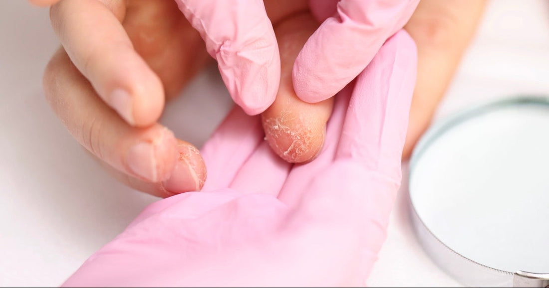 What Causes Gel Nail Allergies? (And HEMA-Free Options)