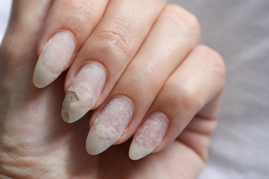 Are Gel Nail Strips Safe? Allergies and HEMA Explained